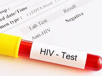 HIV洗精